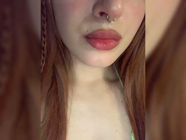  lollypopss